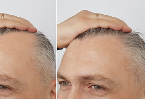 Rescue Hair 911 benefits